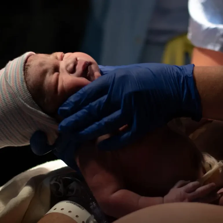 Sonoma birth photographers image of a newborn baby just after being born in the hospital
